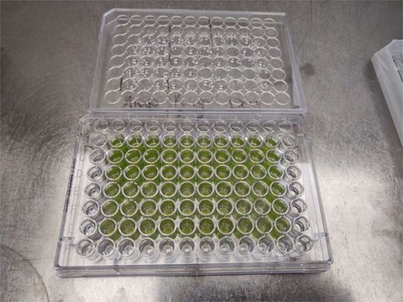 Microalgae – multitalented organisms for a livable future?